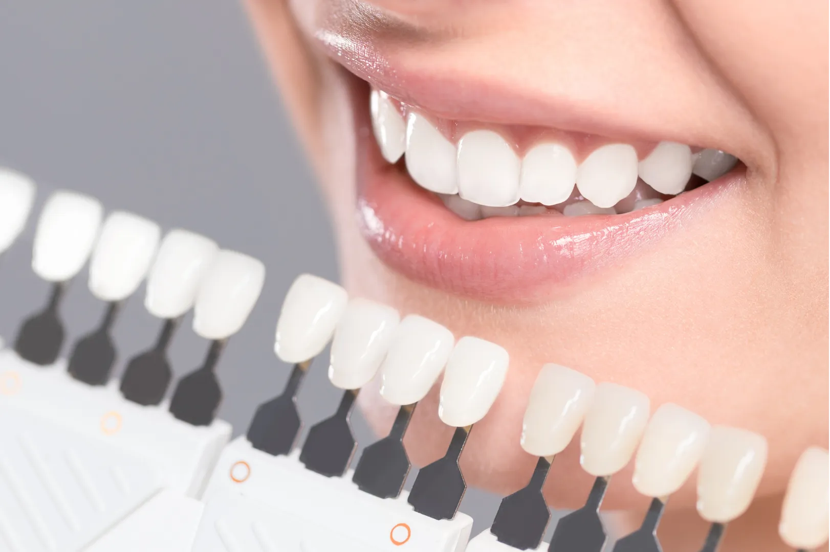 Teeth-Whitening-e1633563054902
