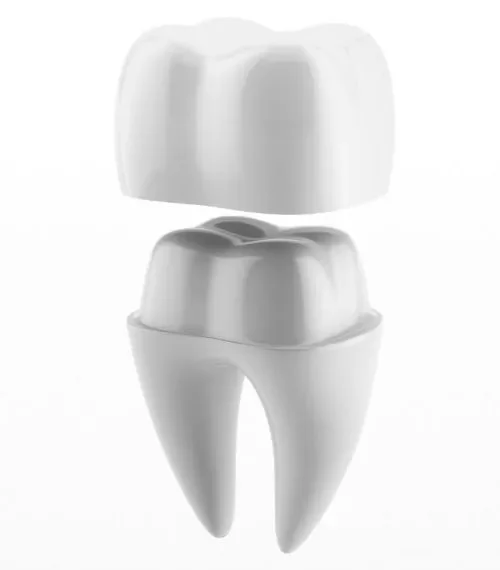 Dental Crown Brisbane Pr2ei49m29r1qz8s8cgzstod2joob5ad8vxs0tfsjo Qq5fi8dnv8pantqmoidgatiewi8iodr9916m991npg